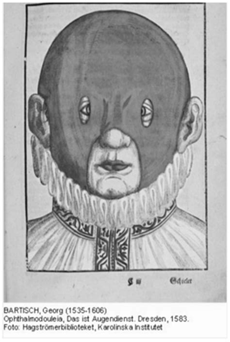 Binasal Occlusion (BNO), Visual Motion Sensitivity (VMS), and the ...