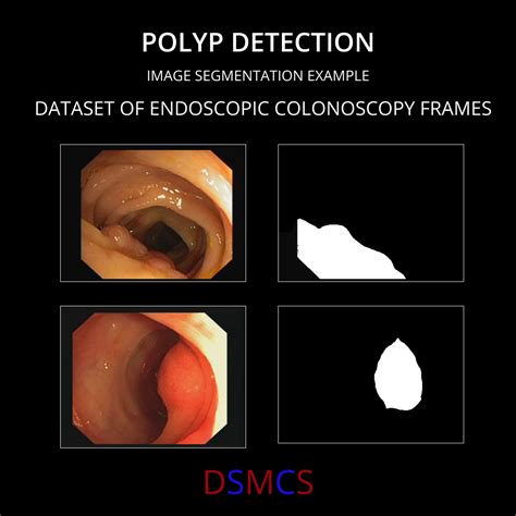 Generate Image From Segmentation Map Using Deep Learning 的图像结果