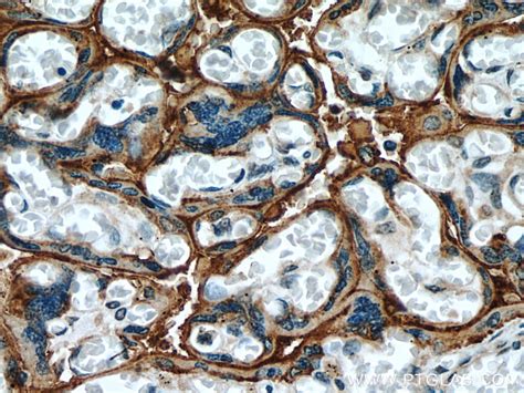PLAC8L1 antibody (25435-1-AP) | Proteintech
