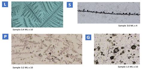 Light Microscopy and Proteomic Patterns of Ovulation in Cervical Mucus