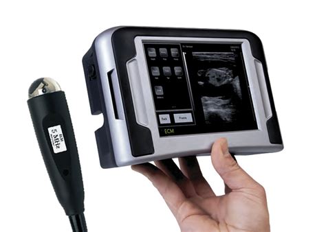 IMAGO ‘S’ es un ecógrafo ultra portátil sectorial de última generación