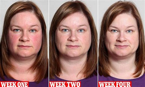 Quitting Alcohol Steps To Stop And Stages Of Alcoholism