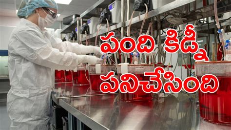 Kidney Transplantation: కిడ్నీ మార్పిడి చరిత్రలో పెద్ద ముందడుగు ...