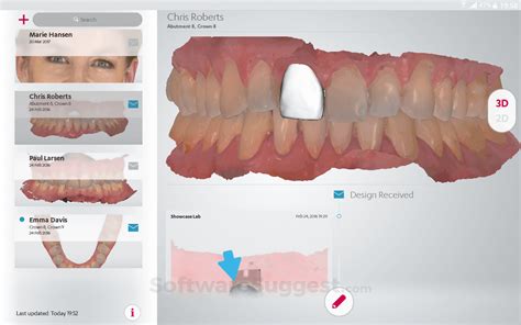 Image result for 3Shape Design Software