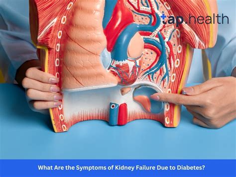 What Are the Symptoms of Kidney Failure Due to Diabetes? (2026 Guide)