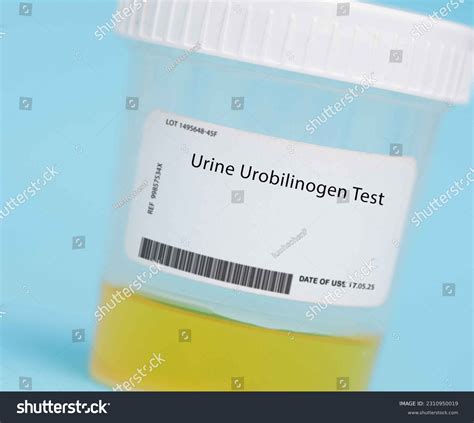 Urine Urobilinogen Test This Test Measures Stock Photo 2310950019 ...