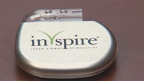 Implantable device offers relief for severe cases of sleep apnea