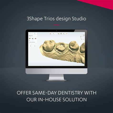 3Shape Design Studio 的图像结果