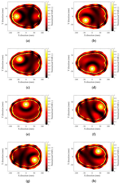 Microwave Hyperthermia of Brain Tumors: A 2D Assessment Parametric ...