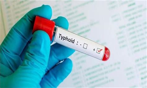 शरीर को अंदर से तोड़ता है Typhoid, जानिए इसके लक्षण और घरेलू उपचार ...