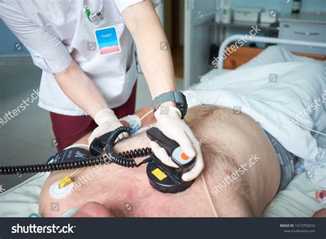 Image result for Synchronized Cardioversion Doses