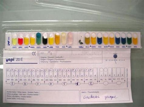 Image result for API Biochemical Test Kit