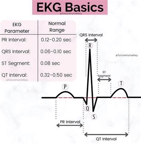 EKG Basics - MEDizzy