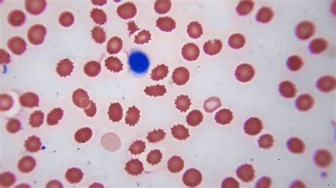 Image result for WBC Count Microscope