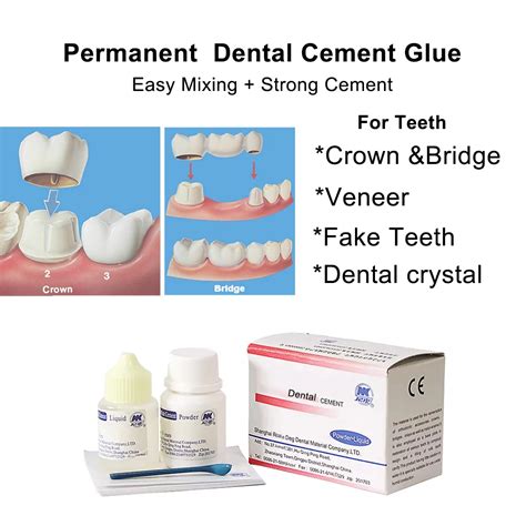 Tooth Crown Cement 的图像结果