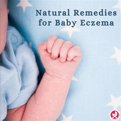 12 Natural Remedies for Baby Eczema