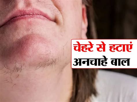 Chehre Ke Baal Hatane Ka Tarika | Home Made Hair Removal Pack | चेहरे ...