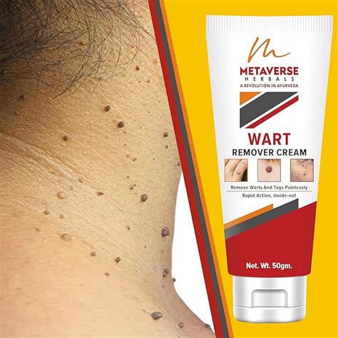 Buy Metaverse Wart Remover Ointment For Men & Women Wart Removal Cream ...