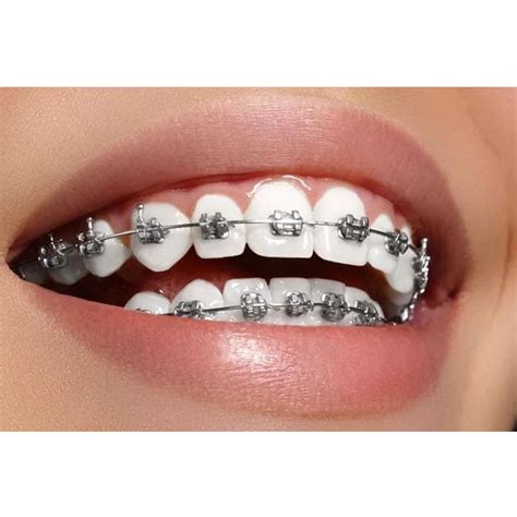 Buy Prime Ortho NiTi Archwires Natural / Pro Form - Round (25/Pk ...
