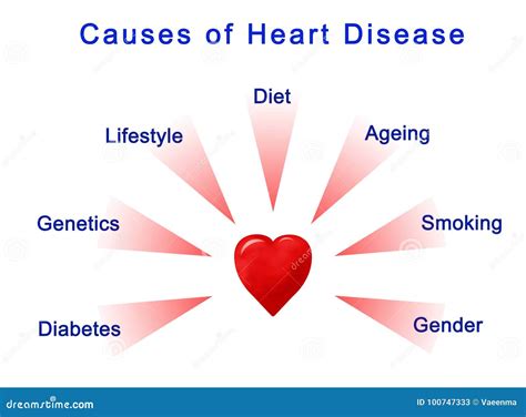 Heart Attack Causes