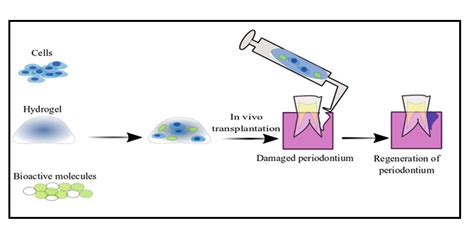 Fig. 3: Regenerative applications of hydrogels [43]