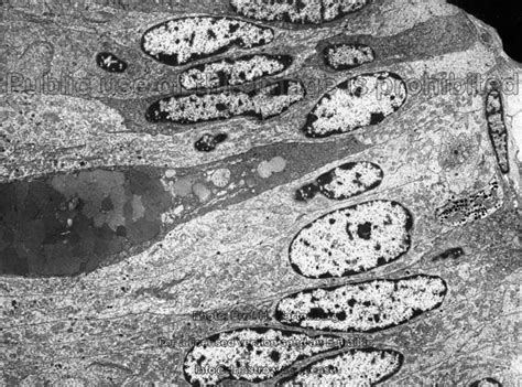 Image result for Jejunum Microscope