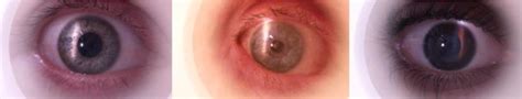 Image result for Slit Lamp Function