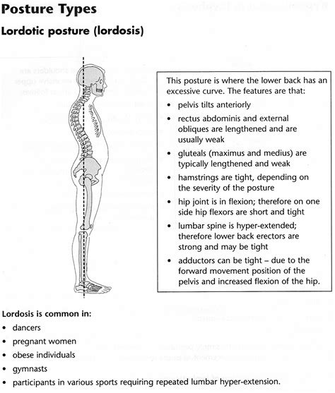 Lordosis Vs Kyphosis