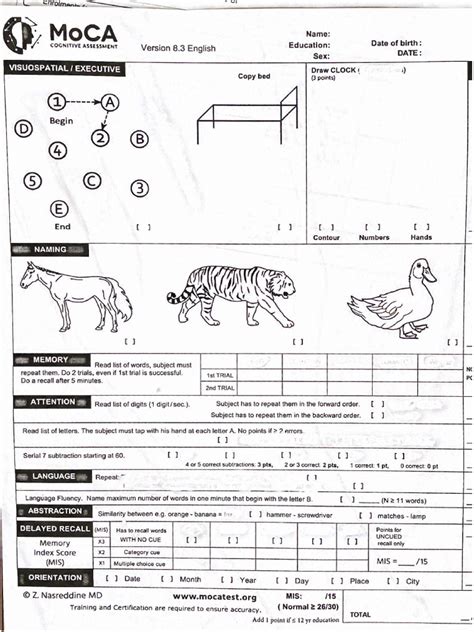 Moca Test Online 的图像结果