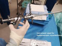 Image result for hysteroscopy