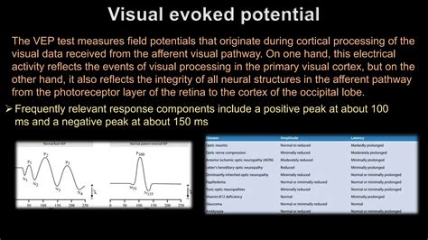 Electrophysiology (Electro-retinogram,Electro-oculogram, Visual evoked ...