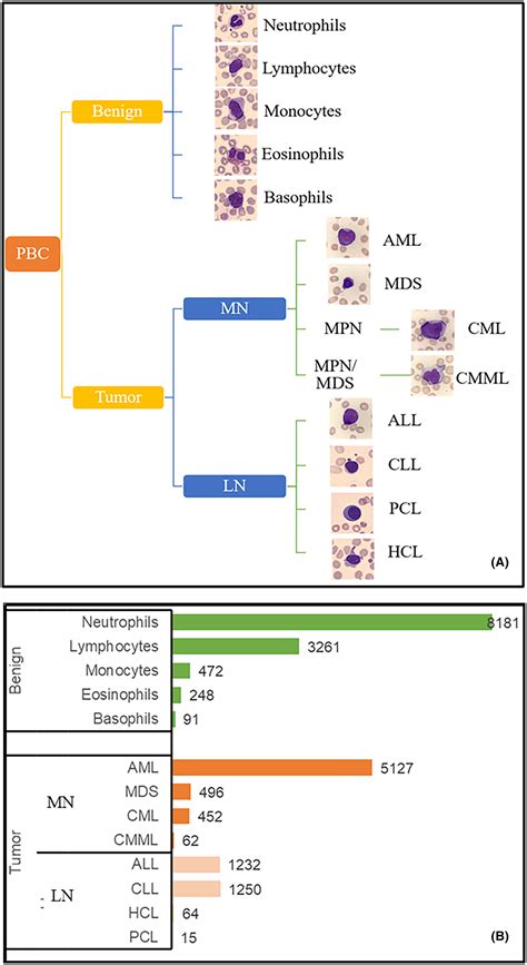 Diagnosis and typing of leukemia using a single peripheral blood cell through deep learning ...