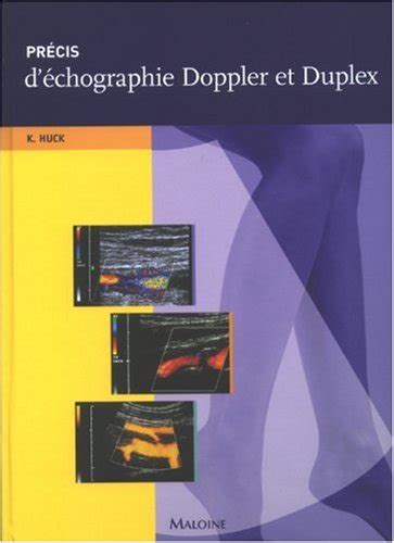 Amazon.in: Buy Precis d'echographie doppler et duplex Book Online at ...