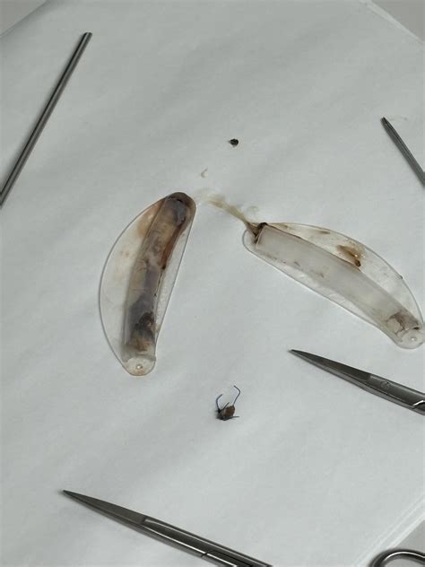 Nasal stents after removal : r/MedicalGore