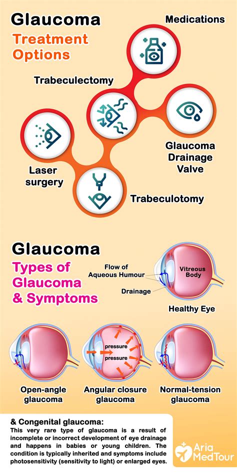 Pin on Glaucoma