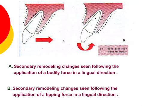 Biology of orthodontic tooth movement | PPT