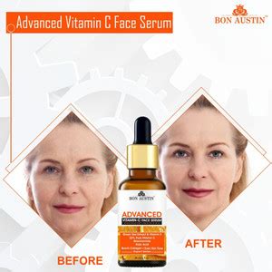 Bon Austin Advance Vitamin C Face Serum For Sun Damage Repair Pack of 2 ...