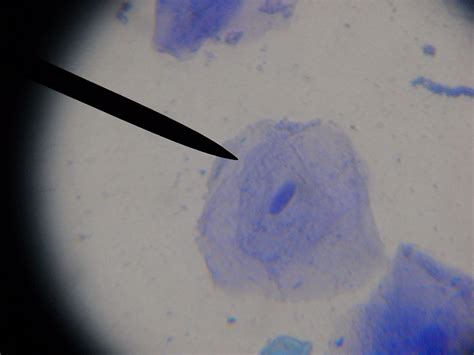 Cheek Cell Under Microscope