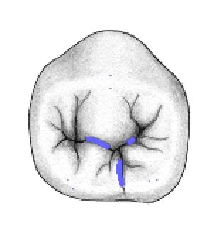 Image result for Contralateral Teeth