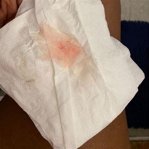 Can.implantation Bleeding Have Clots at Vaughn Josephs blog