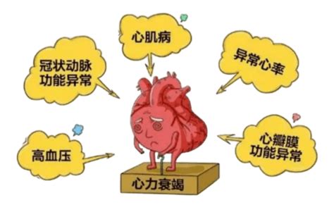 心脏总是“砰砰跳”，或是心律失常的信号，医生教你如何养护_腾讯视频