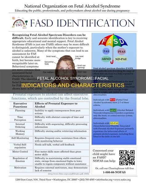 Fetal Alcohol Syndrome: Facial Indicators And Characteristics | CyAlcohol