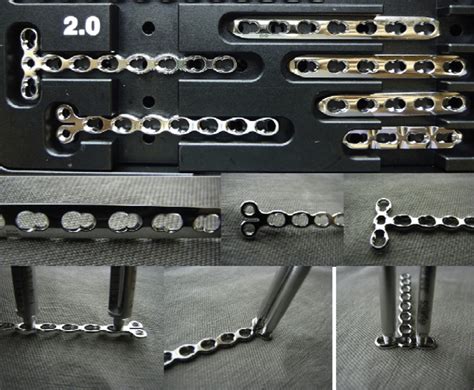 Compression Plate Ao 的图像结果