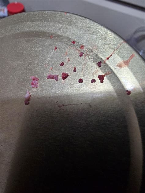 Image result for Exploding Pimple On Bottom