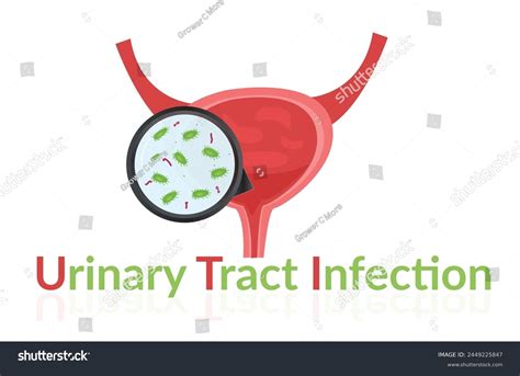 Urinary Tract Infection Clip Art Vector Images Urinary Tract Infection