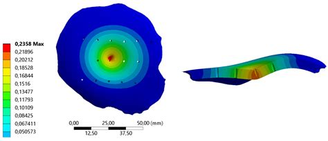 Finite Element Analysis of Patient-Specific Cranial Implants under ...