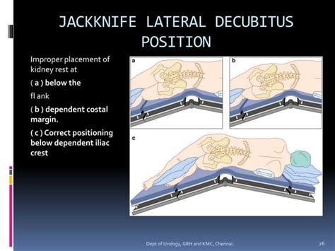 Image result for Nephrectomy Positioning