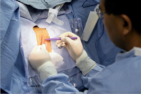 Image result for Labial Reduction Surgery