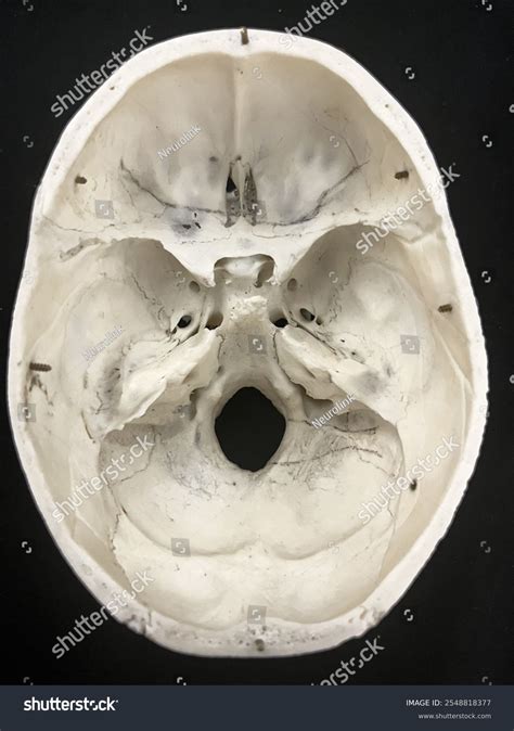 Human Skull Base Anatomy Showing Anterior Stock Photo 2548818377 | Shutterstock