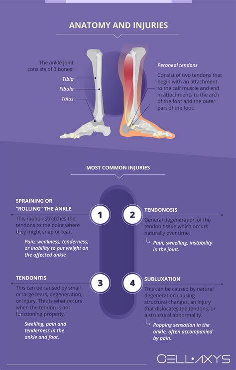 Peroneal Tendonitis Treatment Guide – VEJYCP